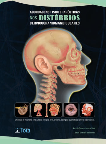 Abordagem Fisioterapêutica nos Distúrbios Cervicocraniomandibulares